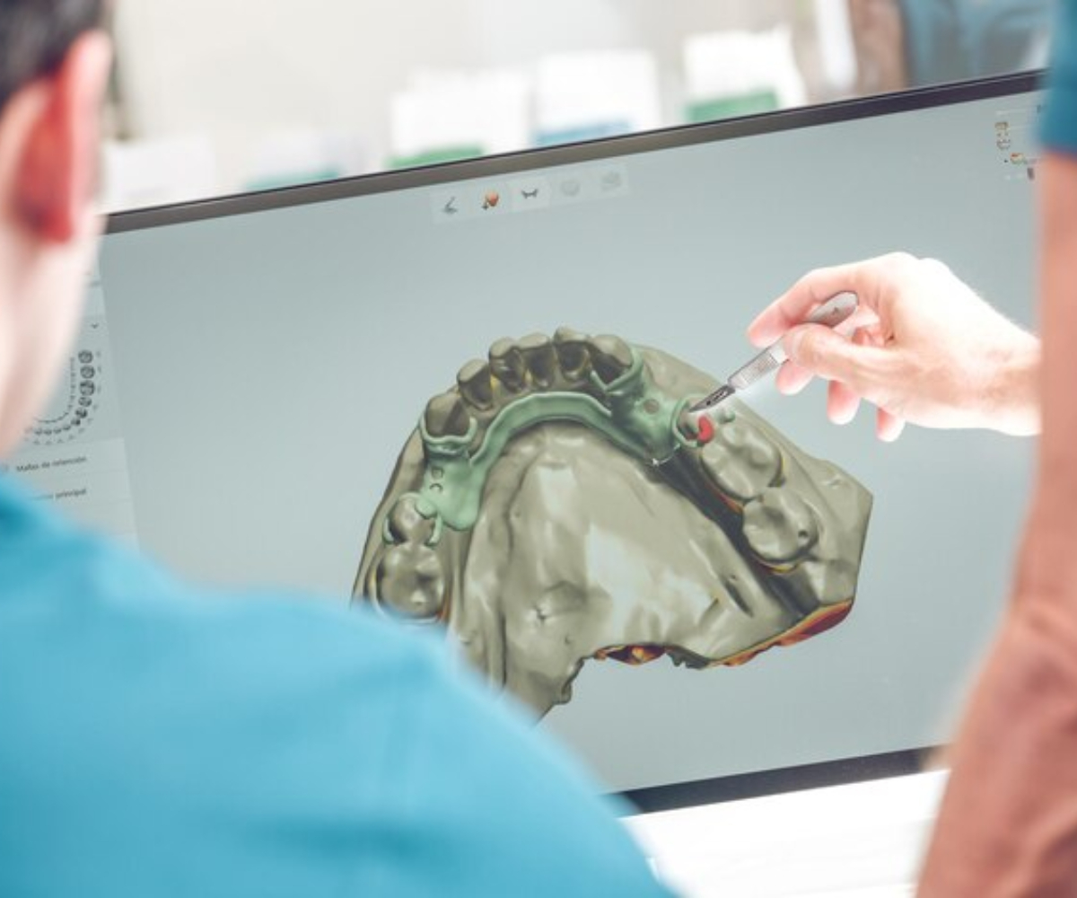 cad cam dental | csd laboratory