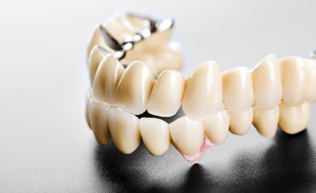 ceramic dental crown | csd laboratory